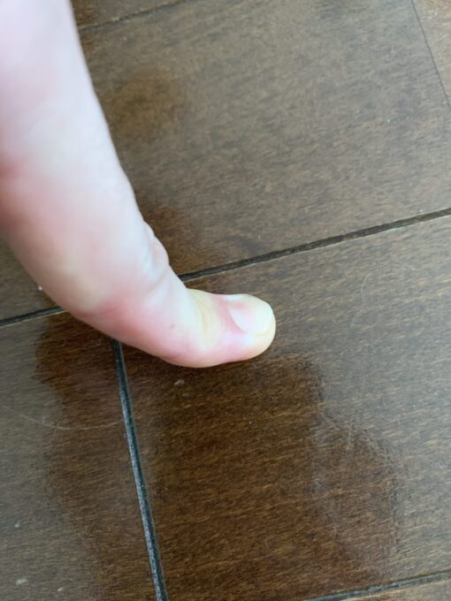 指の腹で弦を押さえた場合