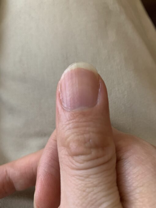 クラシックギター用の指の爪の形