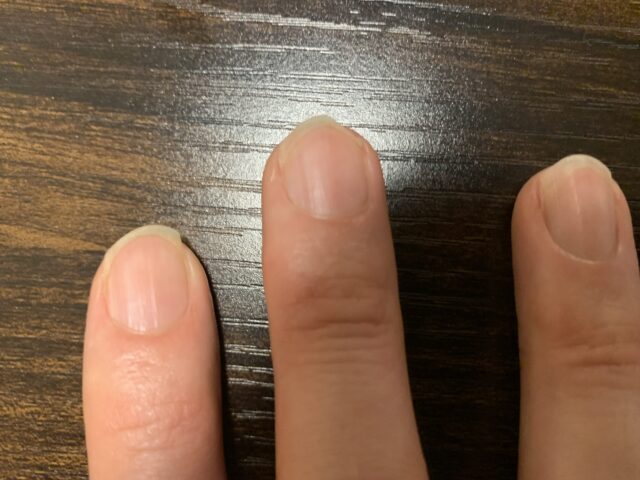 割れてしまったため右側を削り落とした右手中指の爪
